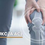 rekonstrukcja-ACL