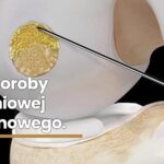 Zabiegi-naprawcze-na-chrząstce-stawowej