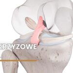 więzadło-krzyżowe-tylne-PCL