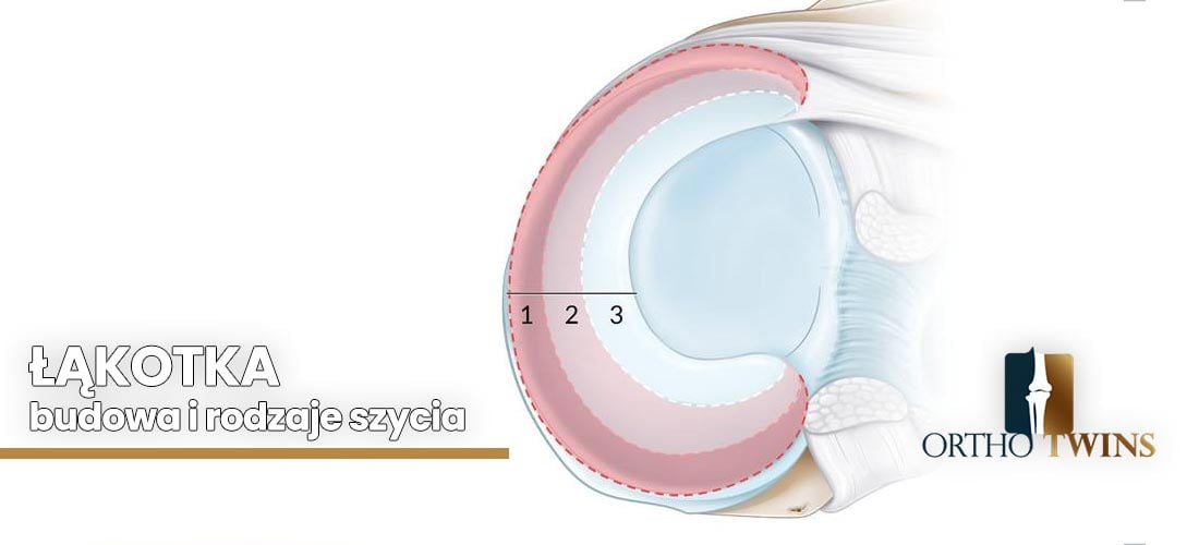 łąkotka---budowa-i-rodzaje-szycia łąkotka---budowa-i-rodzaje-szycia
