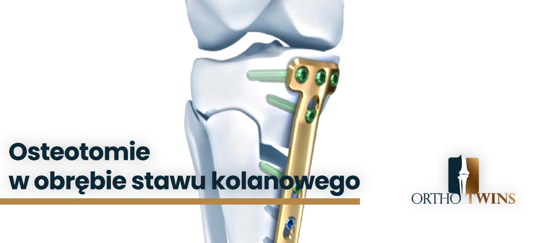 Osteotomie-w-obrębie-stawu-kolanowego